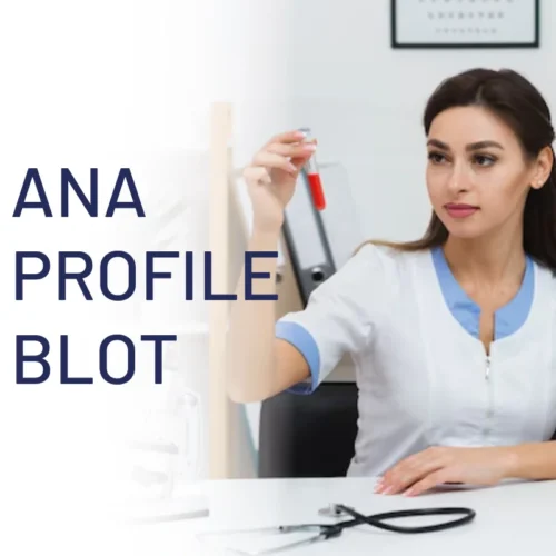 ANAprofileblot
