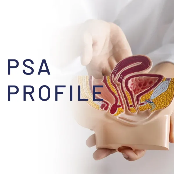 PSA Profile